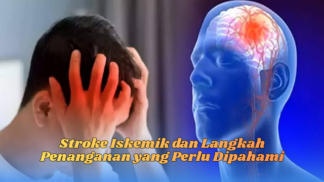 stroke iskemik