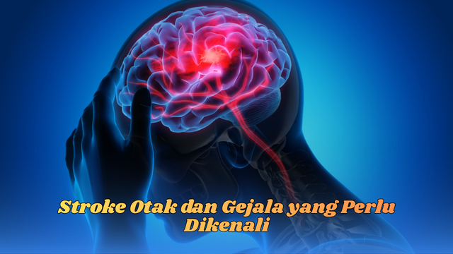 Stroke Otak dan Gejala yang Perlu Dikenali